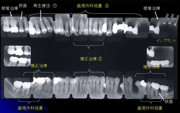 治療計画